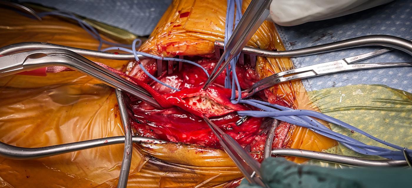 Vascular Surgery Unveiled: Expertise, Innovation, and Care